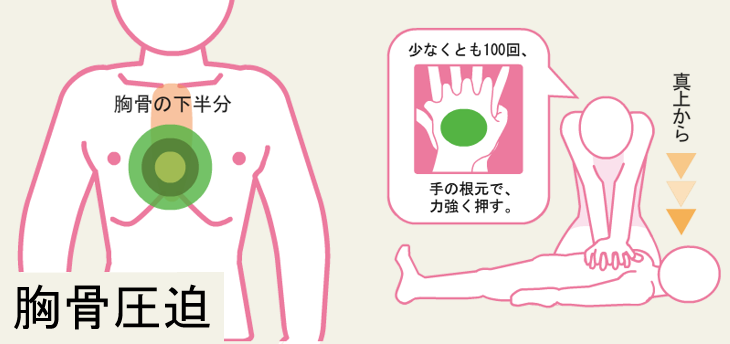 もしも の時にあなたができること 救急蘇生法 君津健康センター